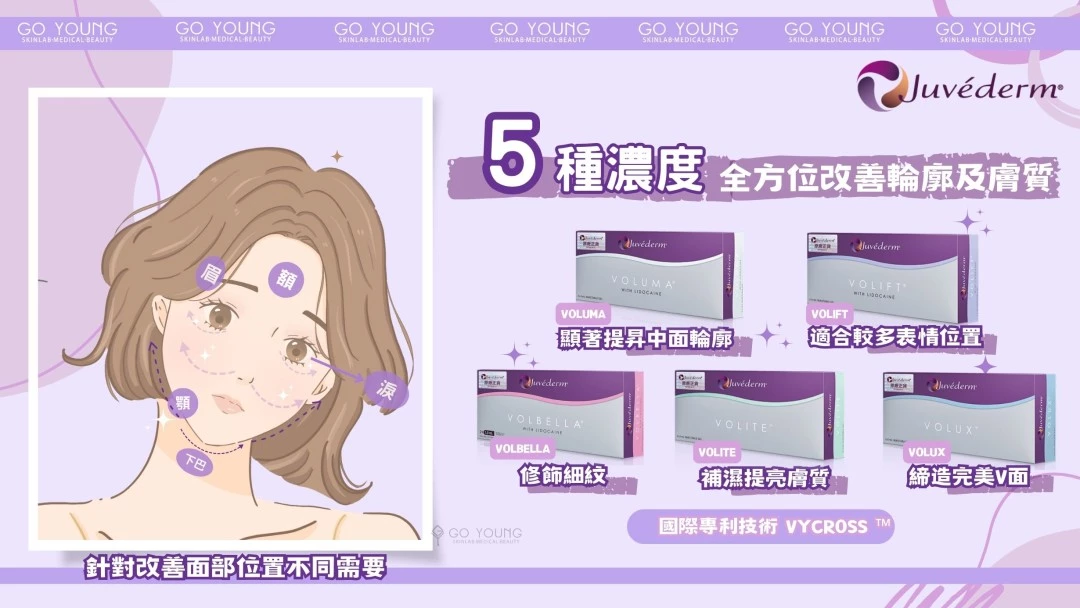 JUVÉDERM® VOLIFT(緹顏)