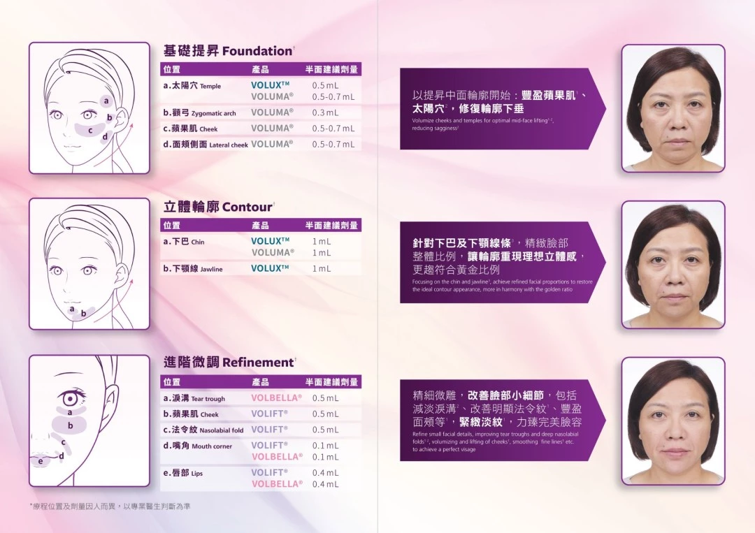 JUVÉDERM® VOLIFT(緹顏)