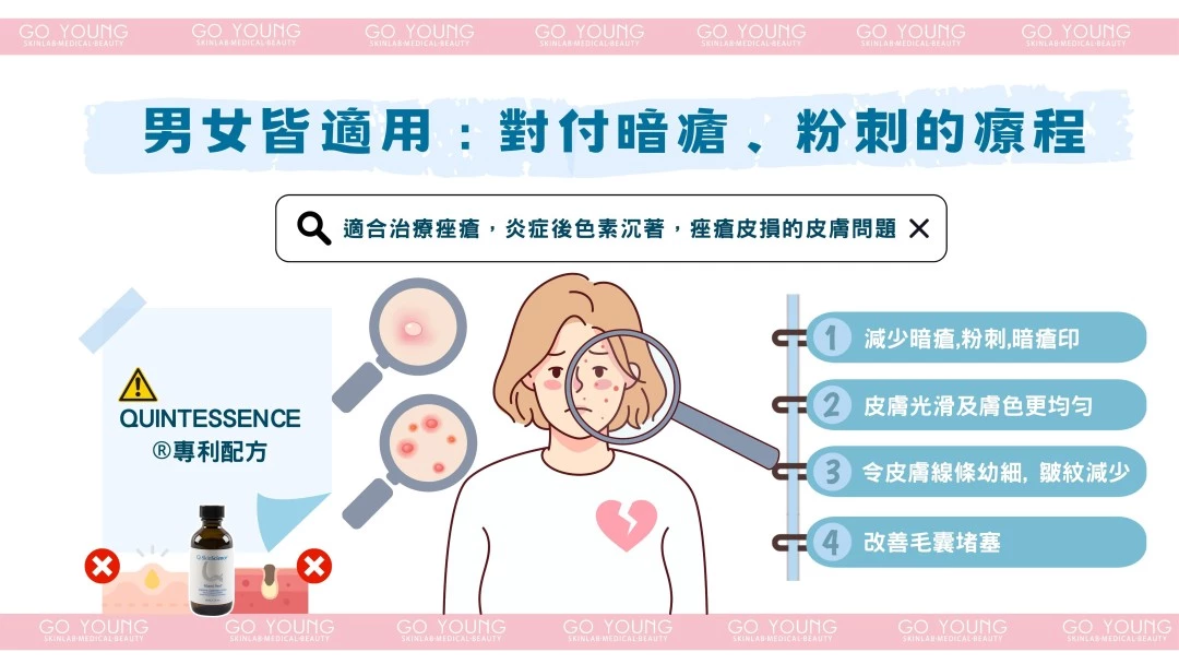 治療師主理|Miami Peel®水楊酸煥膚療程